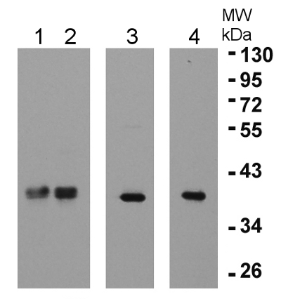 western blot using anti elongation factor beta 1 and beta 2antibodies